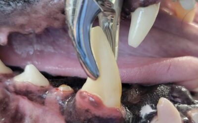 Tooth Extractions: When and Why Are They Needed?